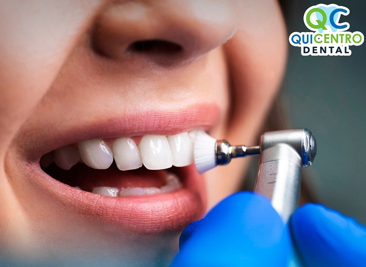 Restaurante QUICENTRO DENTAL